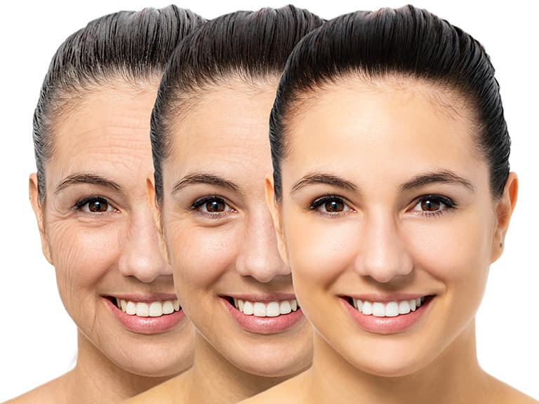 slider-bas-rajeunissement-anti-age-du-visage