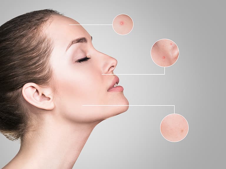 slider-bas-soin-visage-anti-imperfections