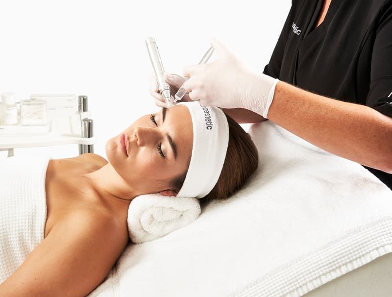 microneedling