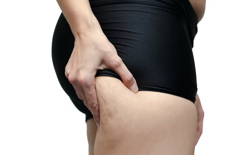 perdre-sa-cellulite-3