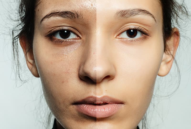 rajeunissement-anti-age-2