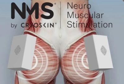 nms-cryoskin2