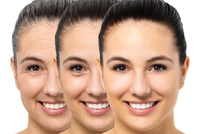 slider-bas-rajeunissement-anti-age-du-visage